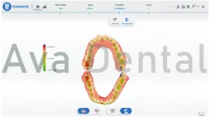 اسکنر لینک تماس‌های اکلوزالی را به‌صورت قابل‌درک، با استفاده از نقشه حرارتی (Heat Map) و نمای مقطعی نمایش می‌دهد،