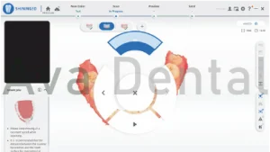 تشخیص حرکت دقیق در اسکنر Lync