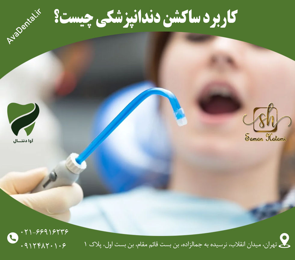کاربرد ساکشن دندانپزشکی چیست؟ | آوادنتال