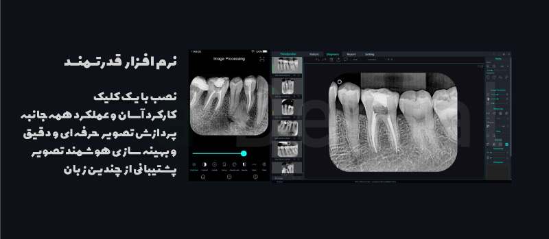 اسکنر فسفرپلیت i Scan Pro وودپیکر Woodpecker 5 شمای-کلی-از-محیط-نرم-افزاری--اسکنر-فسفرپلیت-وودپیکر-iScan-pro-آوادنتال