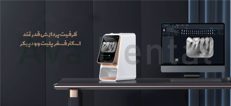 ظرفیت-پردازش-قدرتمند-اسکنر-فسفرپلیت-وودپیکر-i-scan-pro