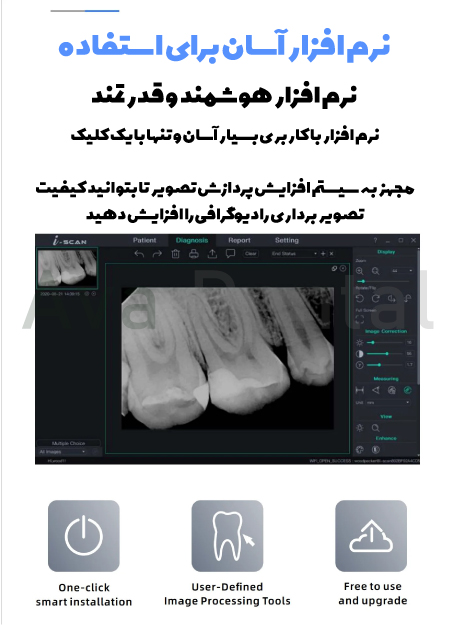 نرم افزار سنسور rvg وودپیکر
