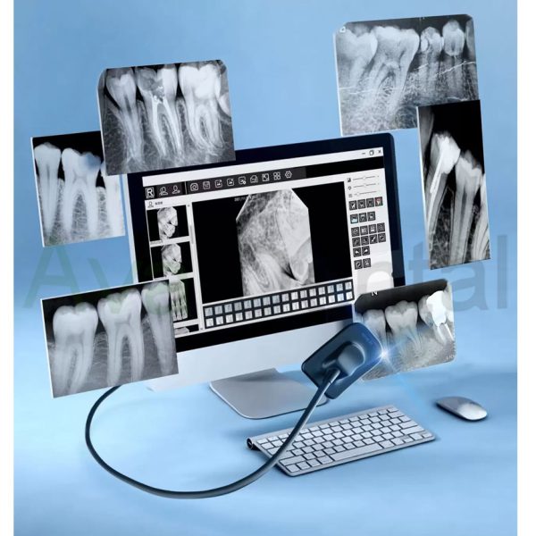 سنسور آر وی جی Dental Sensor ریفاین | آوا دنتال