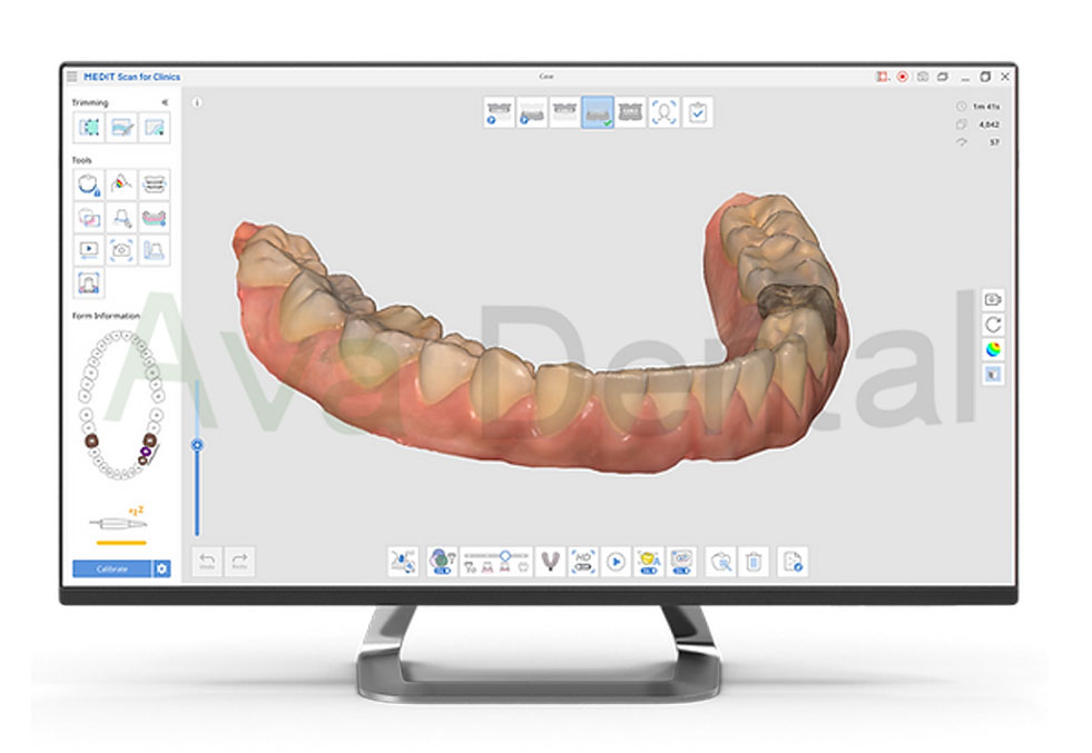 نرم افزار اسکنر داخل دهانی سه بعدی مدیت Medit | آوادنتال