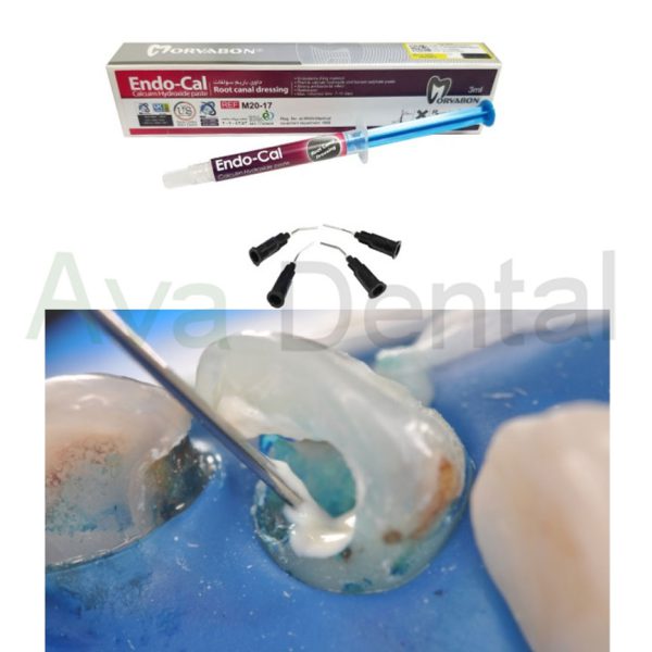 پر کردن با خمیر کلسیم هیدروکساید مروابن Endo-Cal | آوادنتال