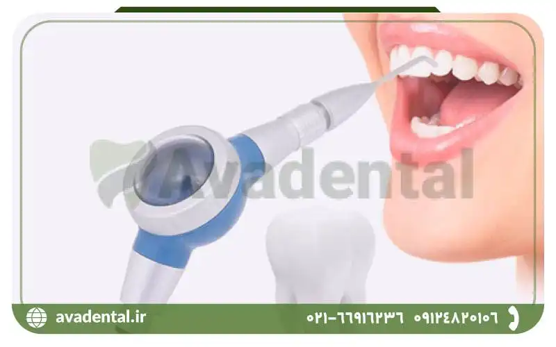 مزیت های ایرفلو دندانپزشکی چیست؟