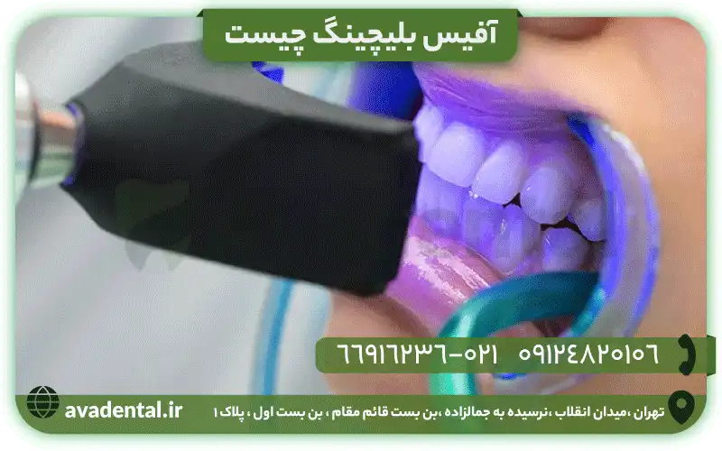 آفیس بلیچینگ چیست؟