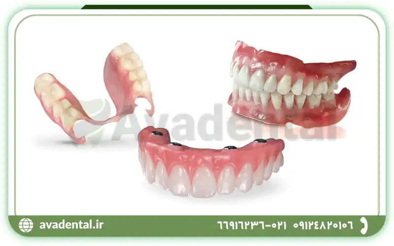 استفاده از دندان مصنوعی یا دست دندان