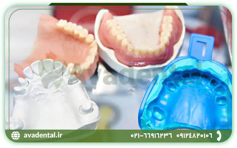 روش های مختلف قالبگیری دندان