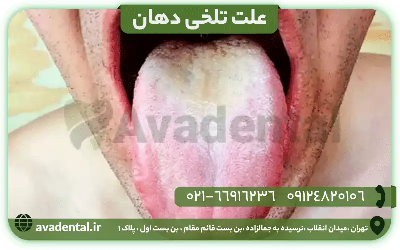 علت تلخی دهان