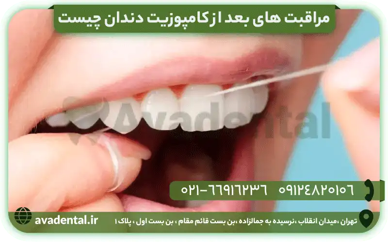 مراقبت های بعد از کامپوزیت دندان
