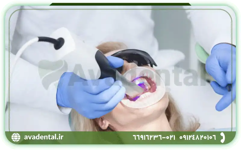 مزایای استفاده از اسکنر داخل دهانی چیست؟