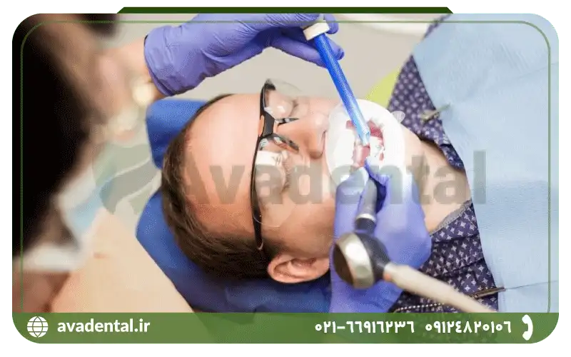 مزایای دستگاه ایرفلو دندانپزشکی