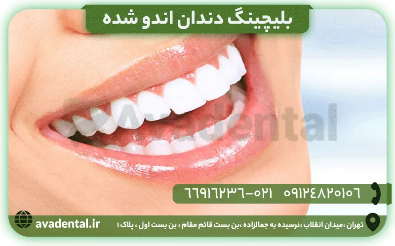 اندو بلیچینگ