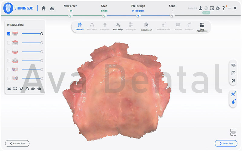 کار با نرم افزار در اسکنر داخل دهانی Aoralscan Elite
