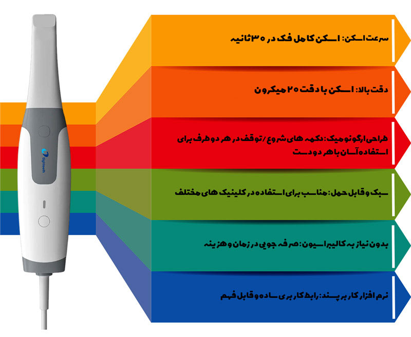 ویژگی های اسکنر داخل دهانی ایتیس