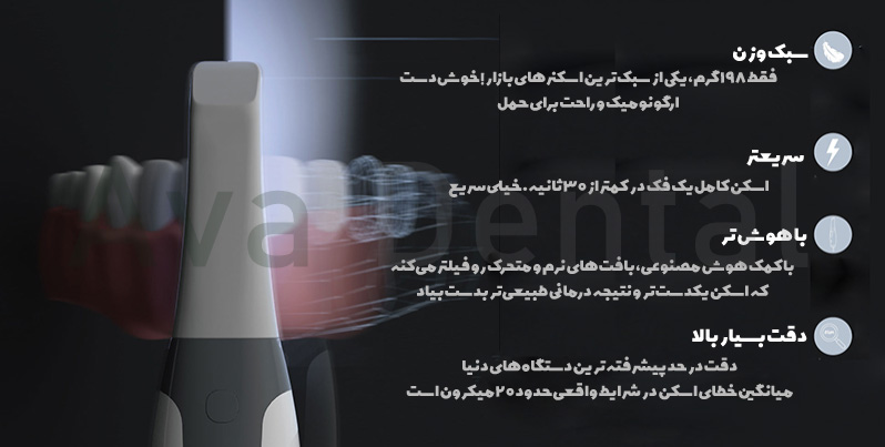 ویژگی-های-استثنایی-در-اسکنر-داخل-دهانی-ایتیس