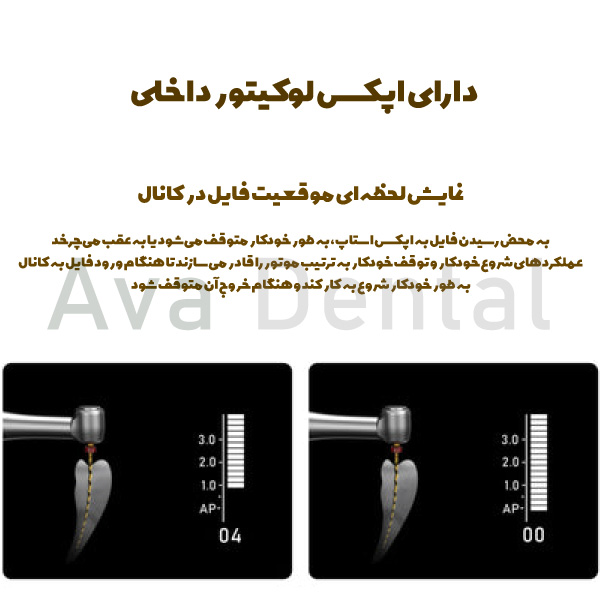 توضیحاتی-درباره-اپکس-داخلی-همراه-دستگاه-اندو-اسپیس-endo-space