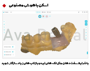 اسکنر داخل دهانی کوین پتر مدل Smile 2 5 اسکنر داخل دهانی مدل اسمایل 2 با قابلیت هوش مصنوعی