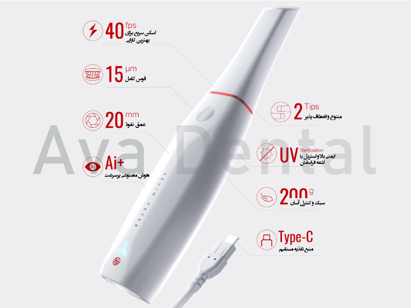 اسکنر داخل دهانی کوین پتر مدل Smile 2 1 ویژگی-های-اسکنر-داخل-دهانی-اسمایل-2-برند-کوین-پتر-0۱