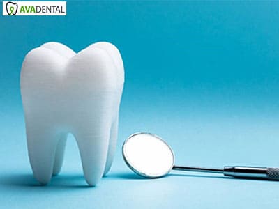 آوا دنتال difference between dental composite and dental laminate